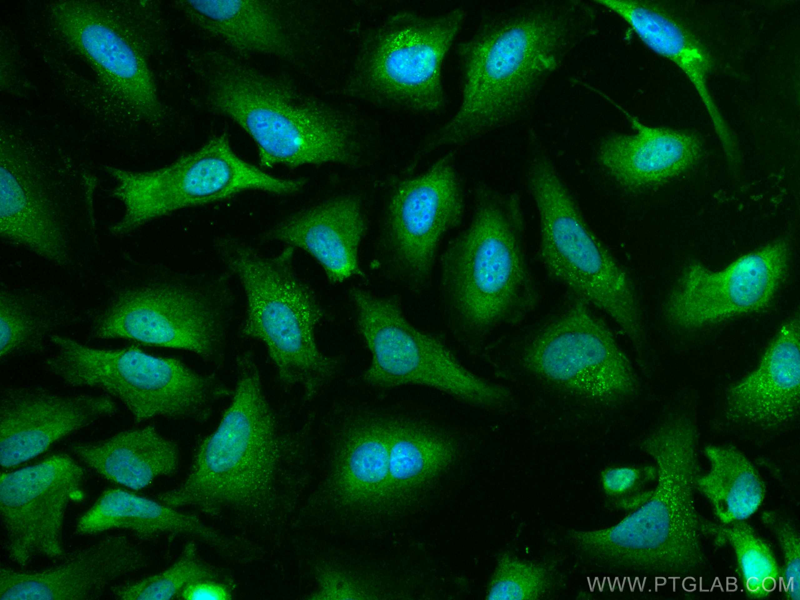 Immunofluorescence (IF) / fluorescent staining of HeLa cells using CoraLite® Plus 488-conjugated Caspase 9/p35/p10 Mo (CL488-66169)
