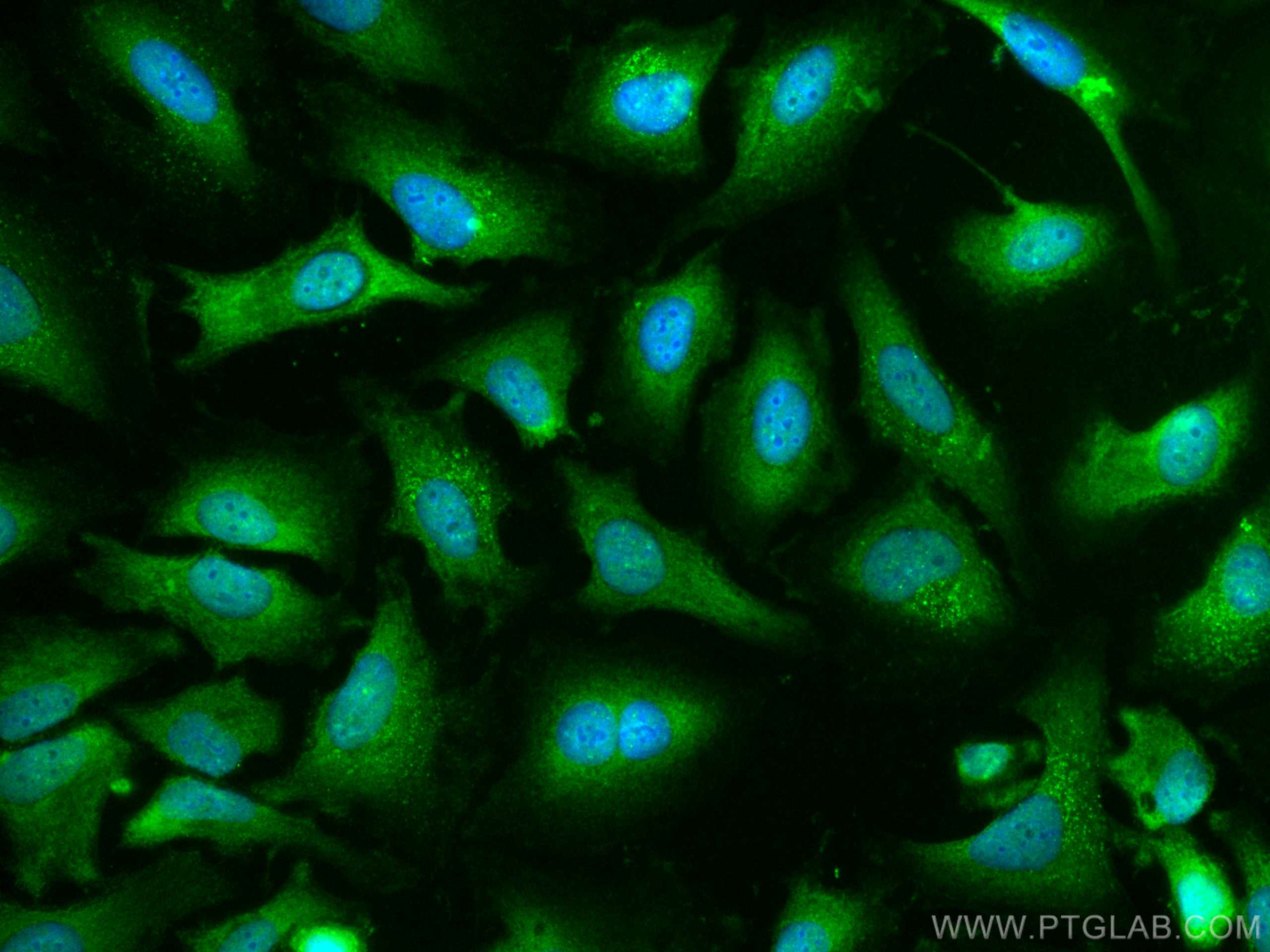 Caspase 9/p35/p10