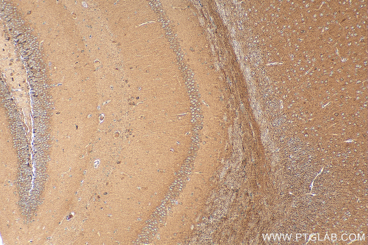 Immunohistochemistry (IHC) staining of mouse brain tissue using Caspr2/CNTNAP2 Polyclonal antibody (25838-1-AP)