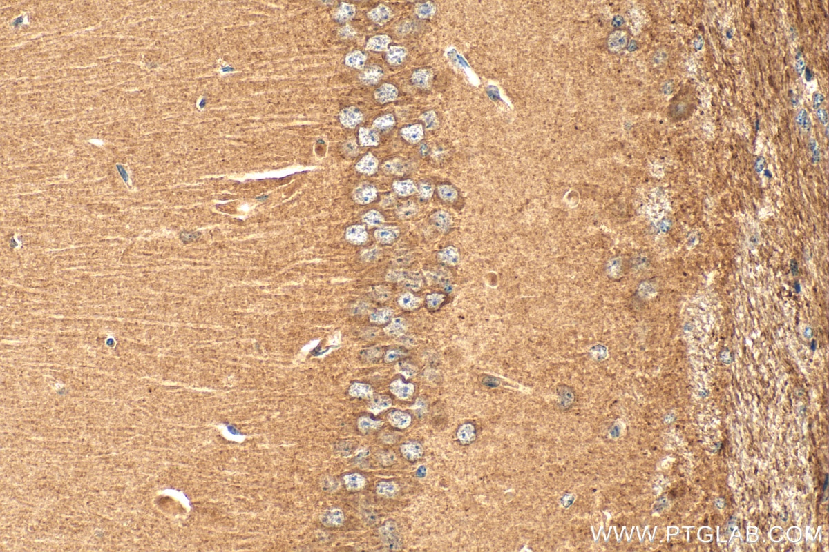 Immunohistochemistry (IHC) staining of mouse brain tissue using Caspr2/CNTNAP2 Polyclonal antibody (25838-1-AP)