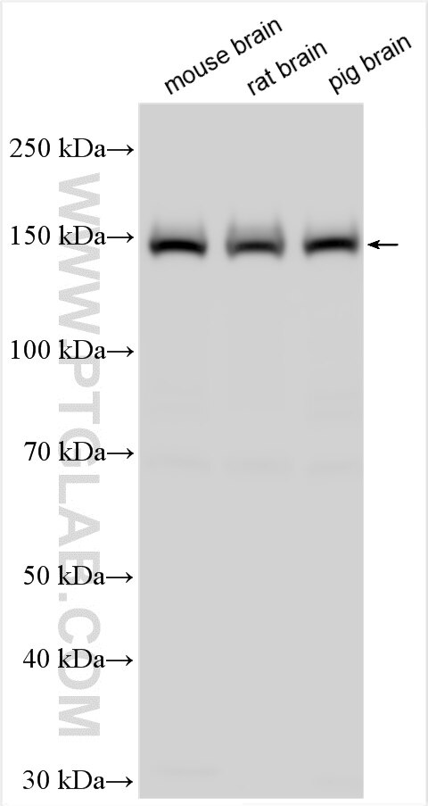 Western Blot (WB) analysis of various lysates using Caspr2 Polyclonal antibody (25838-1-AP)