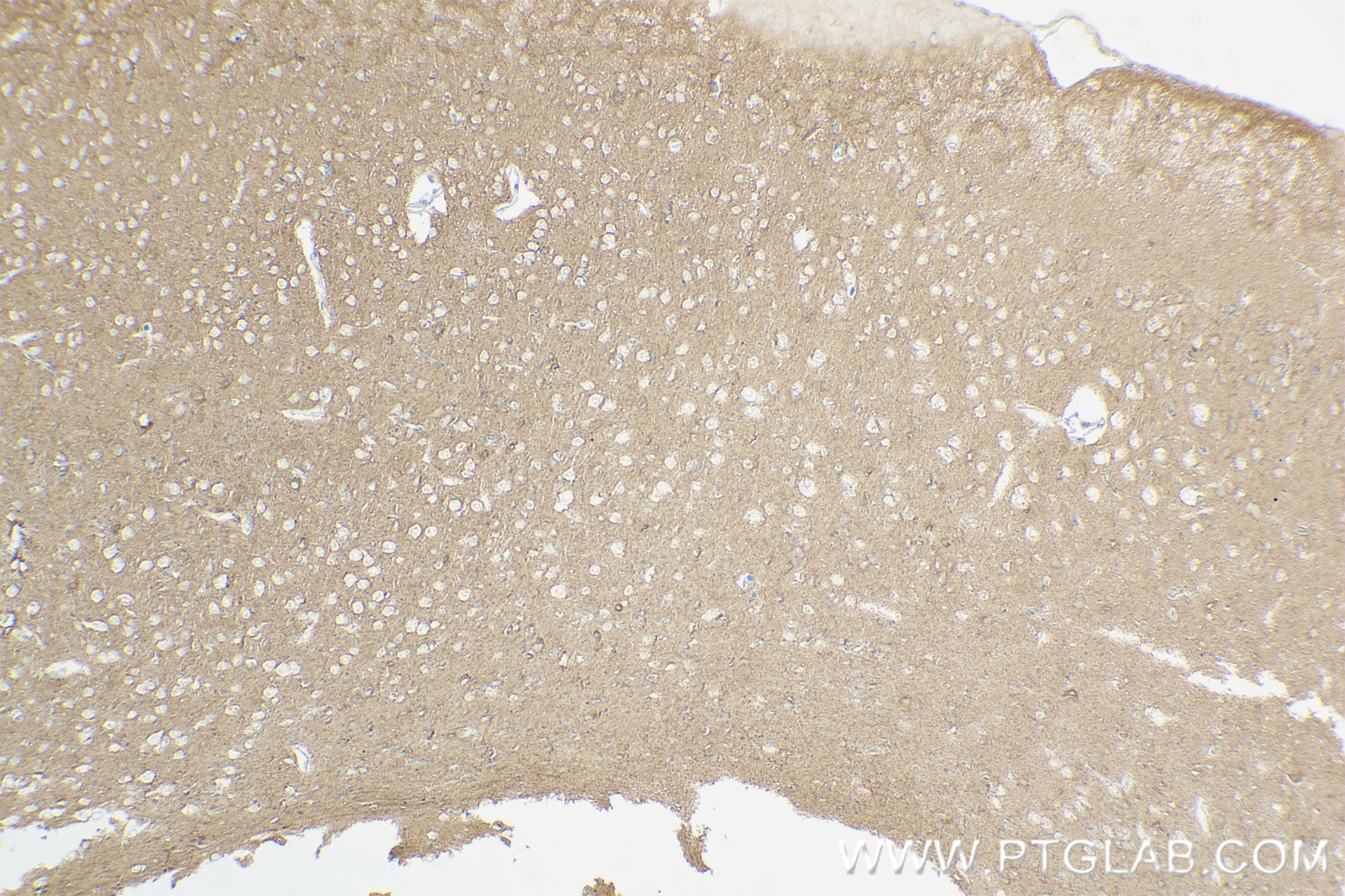 Immunohistochemistry (IHC) staining of mouse brain tissue using Caspr2/CNTNAP2 Recombinant antibody (85116-4-RR)