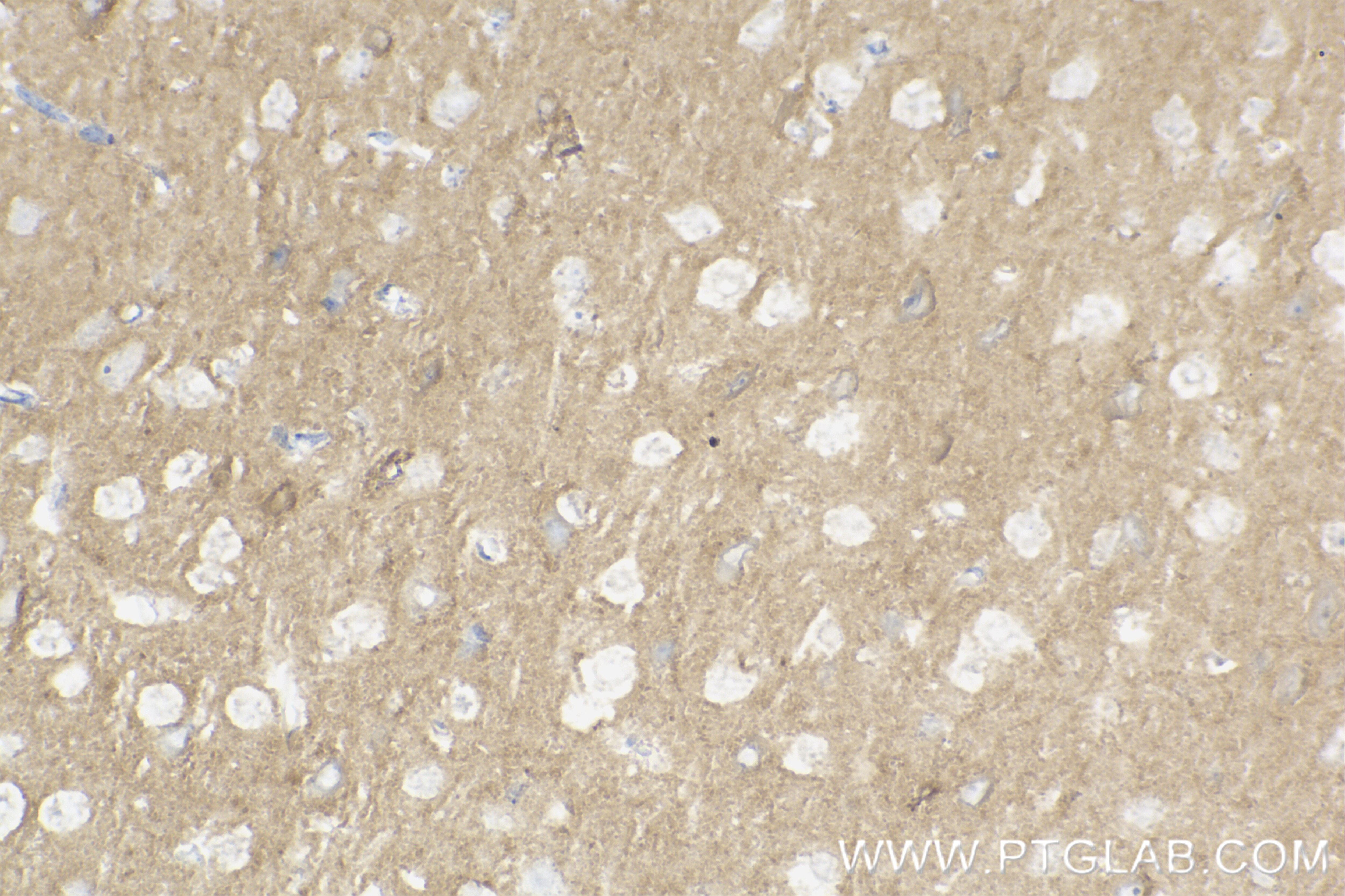Immunohistochemistry (IHC) staining of mouse brain tissue using Caspr2/CNTNAP2 Recombinant antibody (85116-4-RR)