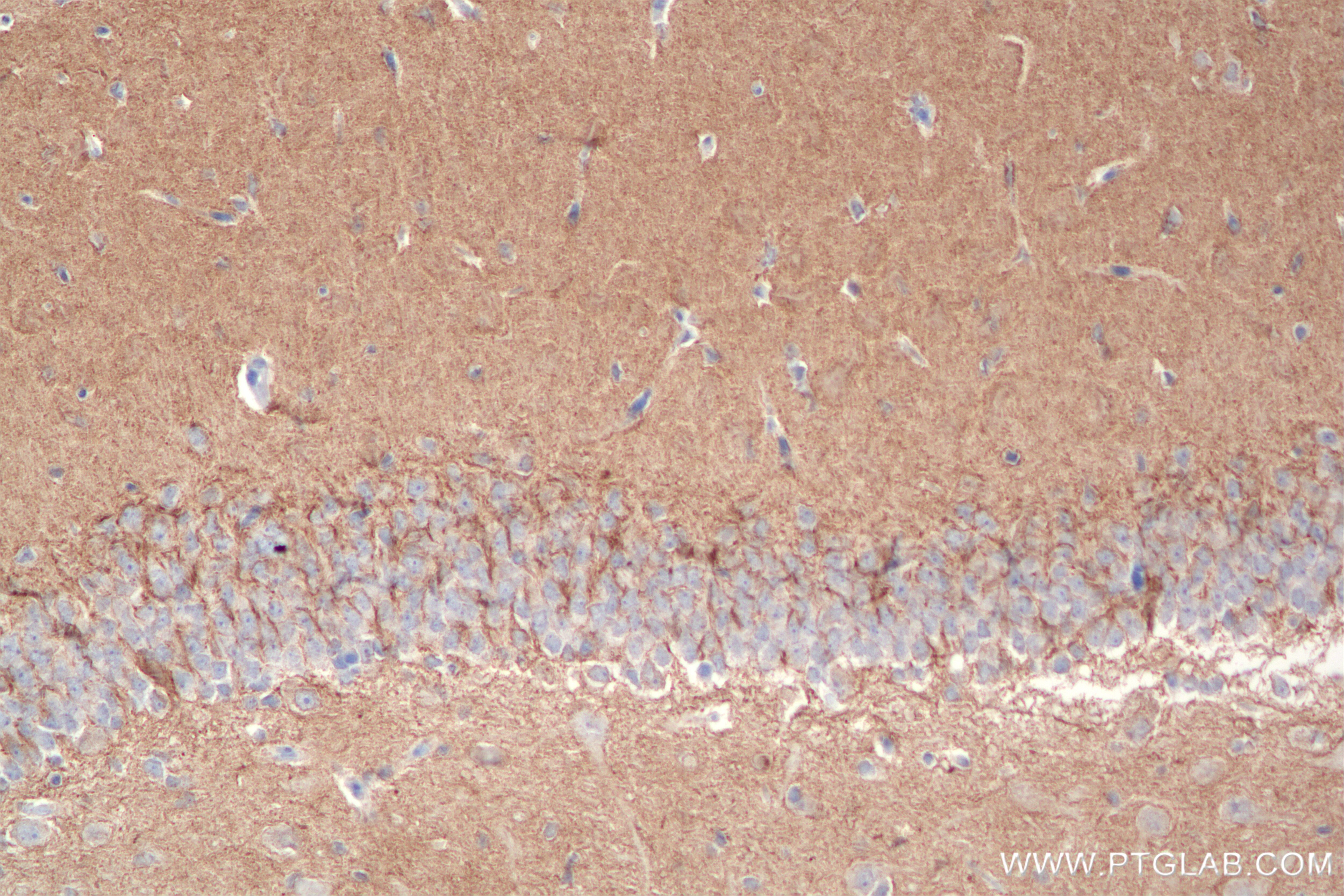Immunohistochemistry (IHC) staining of rat brain tissue using Caspr2/CNTNAP2 Recombinant antibody (85116-4-RR)