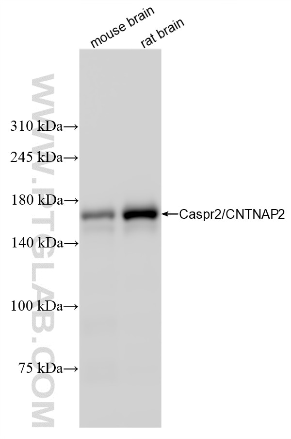 Western Blot (WB) analysis of various lysates using Caspr2/CNTNAP2 Recombinant antibody (85116-4-RR)