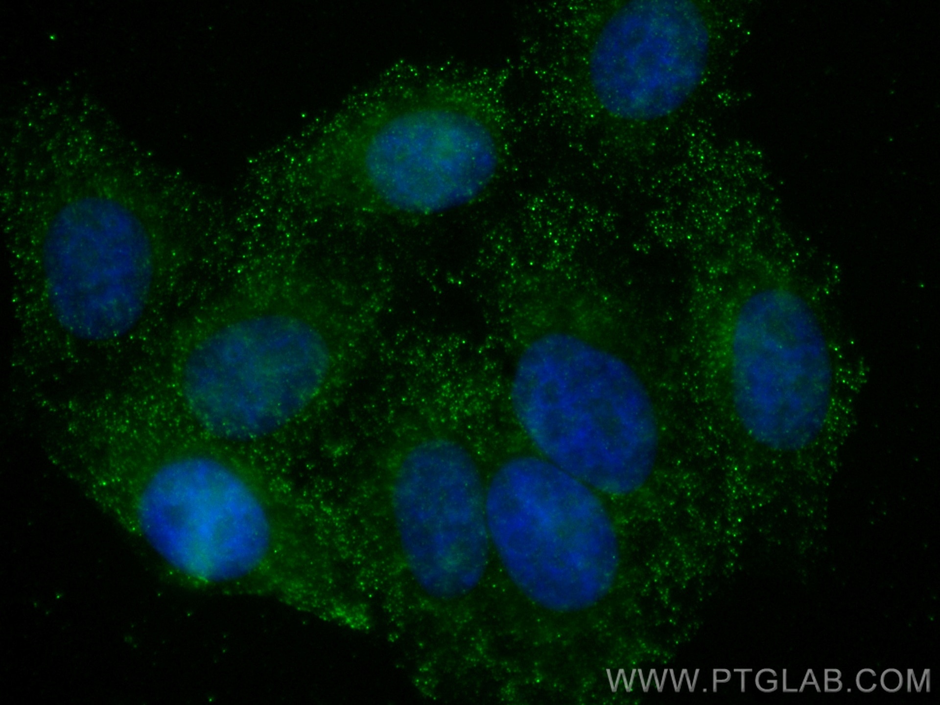 Immunofluorescence (IF) / fluorescent staining of HepG2 cells using Catalase Monoclonal antibody (66765-1-Ig)