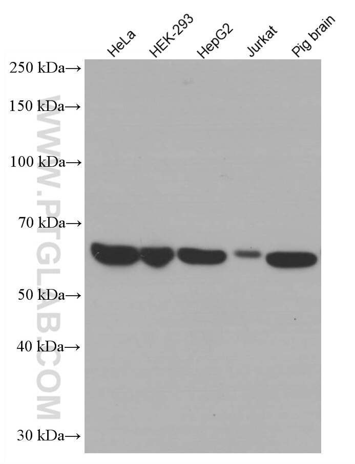 Western Blot (WB) analysis of various lysates using Catalase Monoclonal antibody (66765-1-Ig)