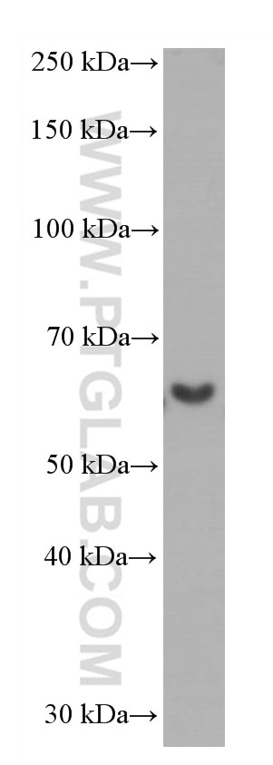 Western Blot (WB) analysis of rat brain tissue using Catalase Monoclonal antibody (66765-1-Ig)