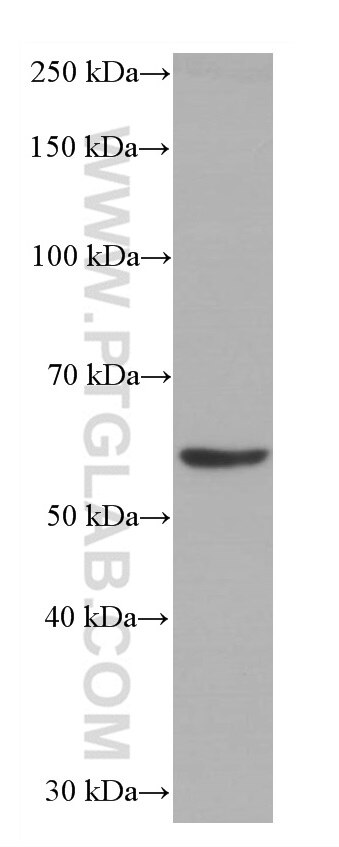 Western Blot (WB) analysis of mouse brain tissue using Catalase Monoclonal antibody (66765-1-Ig)