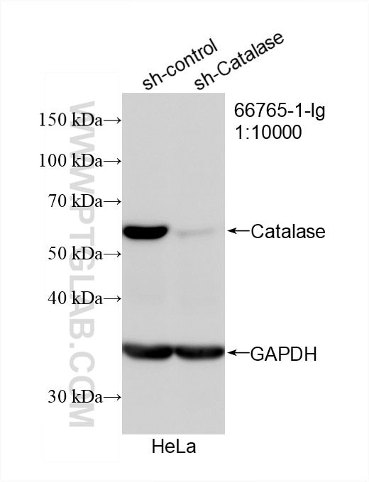 Western Blot (WB) analysis of HeLa cells using Catalase Monoclonal antibody (66765-1-Ig)