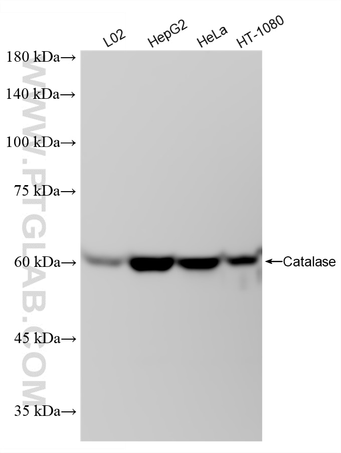 Western Blot (WB) analysis of various lysates using Catalase Recombinant monoclonal antibody (83329-2-RR)
