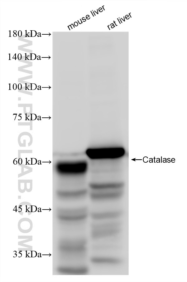 Western Blot (WB) analysis of various lysates using Catalase Recombinant monoclonal antibody (83329-2-RR)