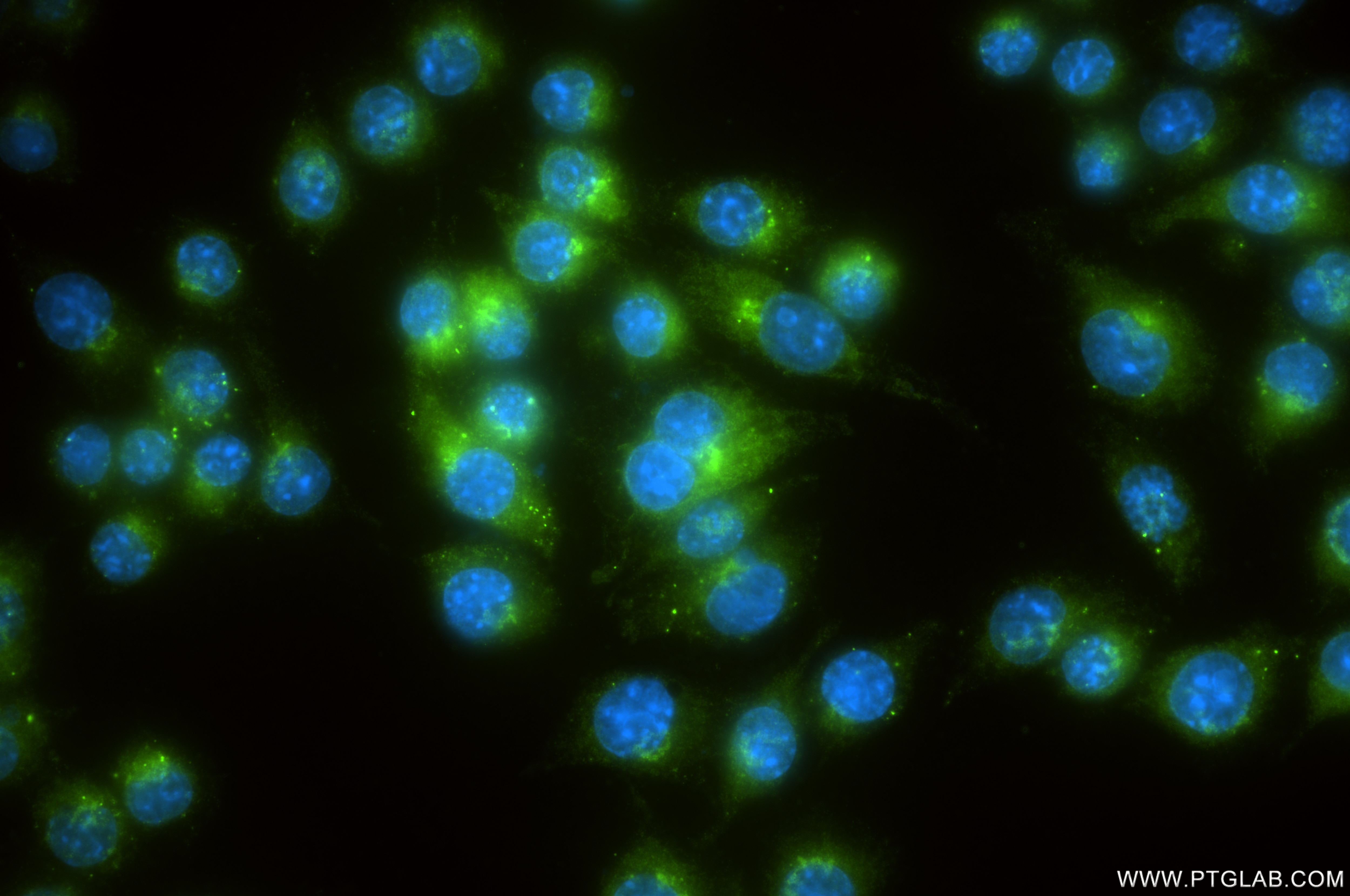 Immunofluorescence (IF) / fluorescent staining of RAW 264.7 cells using Cathepsin B Recombinant antibody (85841-5-RR)