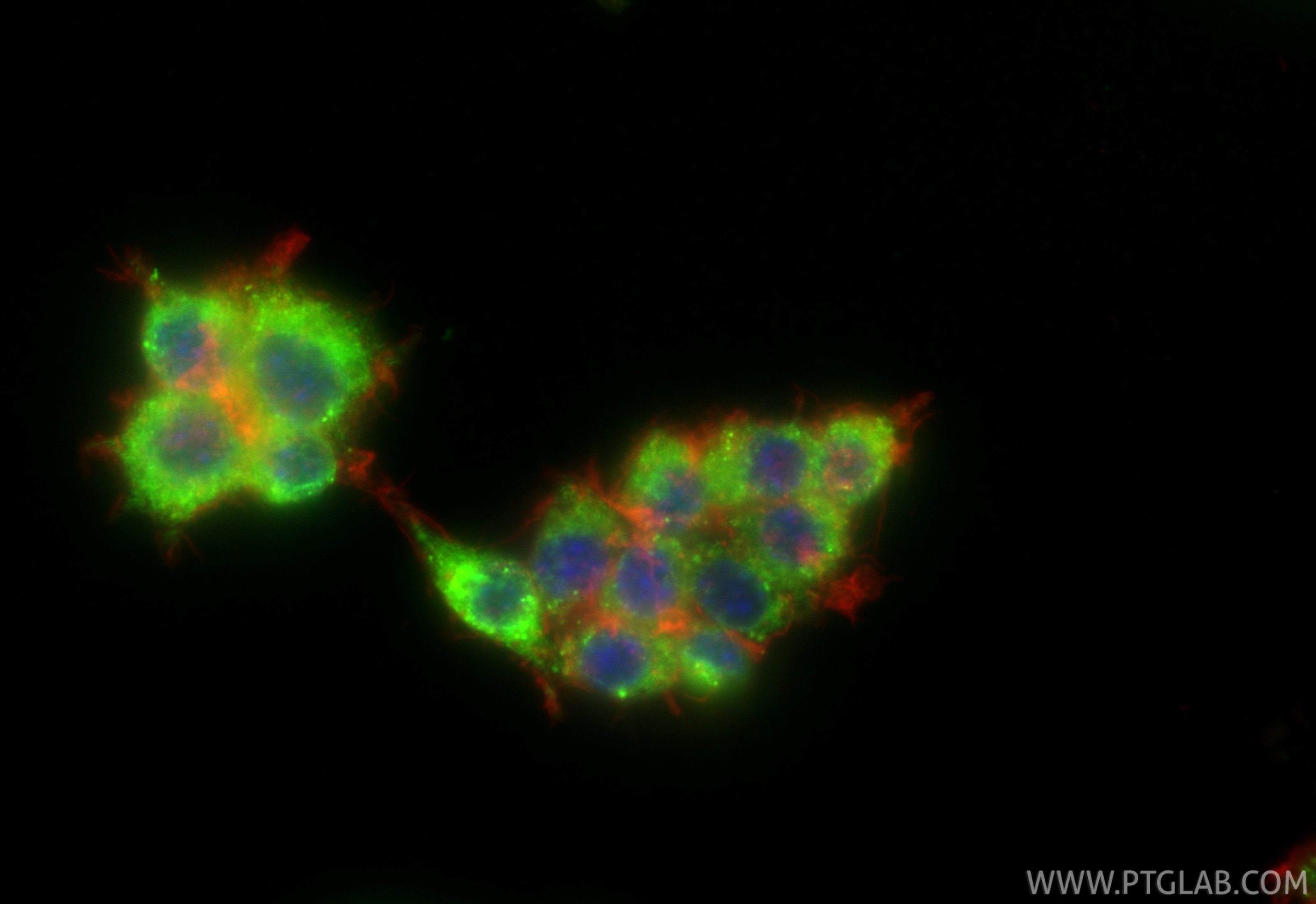 Immunofluorescence (IF) / fluorescent staining of RAW 264.7 cells using Cathepsin B Recombinant monoclonal antibody (85841-5-RR)