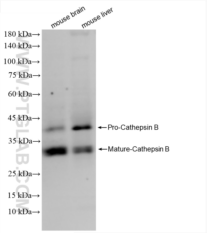 Western Blot (WB) analysis of various lysates using Cathepsin B Recombinant antibody (85841-5-RR)
