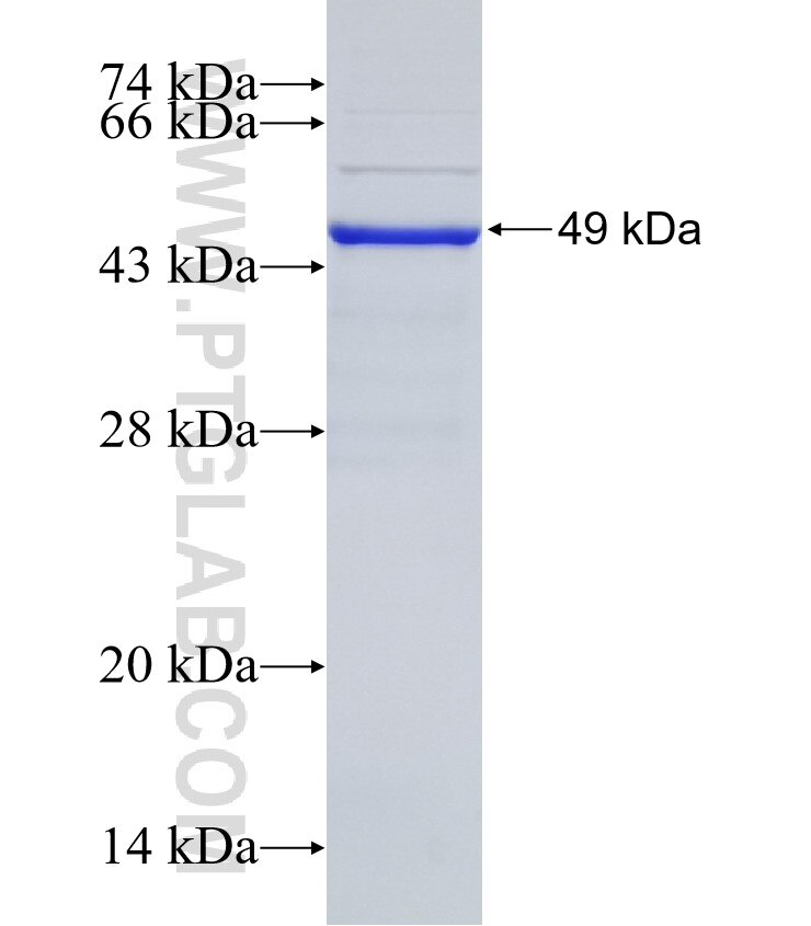 Cathepsin C fusion protein Ag32420 SDS-PAGE