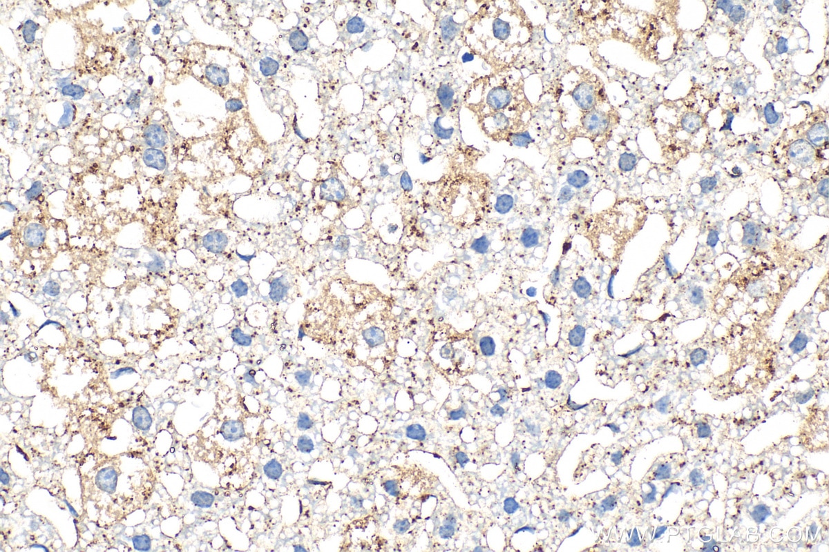 Immunohistochemical analysis of paraffin-embedded mouse liver tissue slide using 31516-1-AP (Cathepsin D antibody) at dilution of 1:400 (under 40x lens). Heat mediated antigen retrieval with Tris-EDTA buffer (pH 9.0). Immunohistochemistry (IHC) staining of mouse liver tissue using Cathepsin D Polyclonal antibody (31516-1-AP)