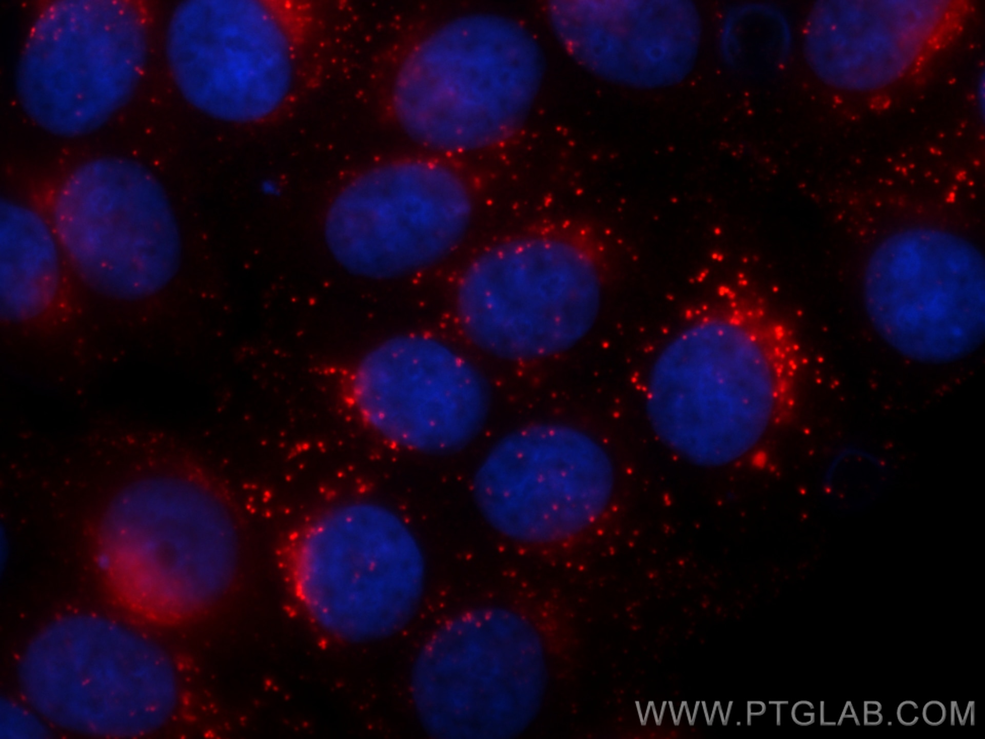 IF Staining of MCF-7 using RMX00012 Immunofluorescence (IF) / fluorescent staining of MCF-7 cells using Multi-rAb® Cathepsin D Multi-Recombinant antibody (RMX00012)