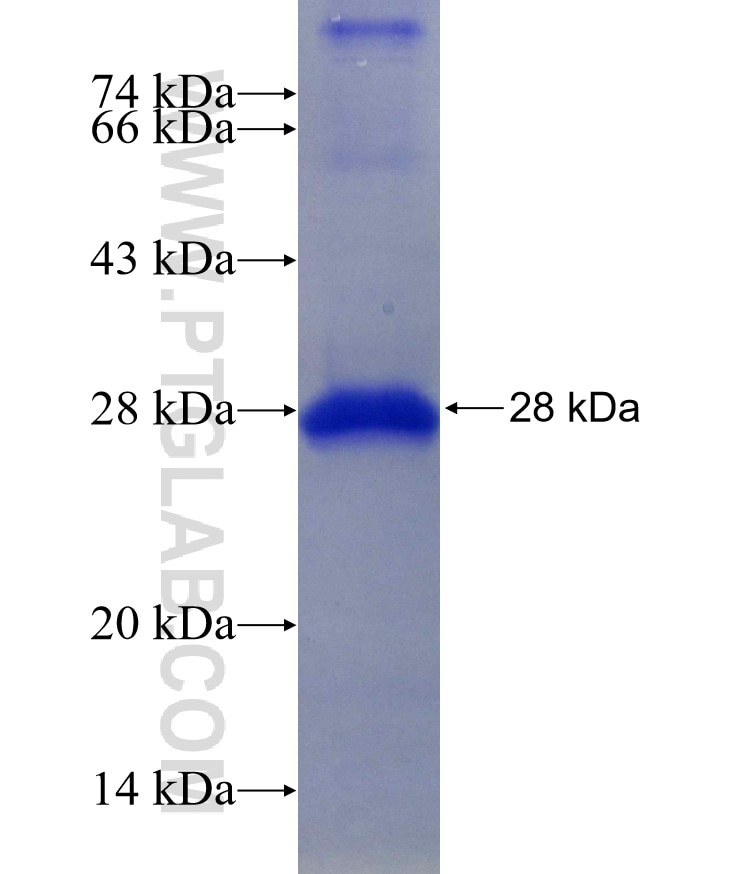 Cathepsin D fusion protein Ag27291 SDS-PAGE