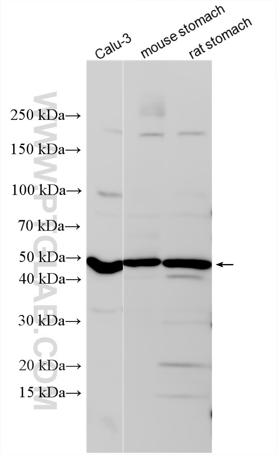 Various lysates were subjected to SDS PAGE followed by western blot with 25146-1-AP (Cathepsin E antibody) at dilution of 1:1000 incubated at room temperature for 1.5 hours. Western Blot (WB) analysis of various lysates using Cathepsin E Polyclonal antibody (25146-1-AP)