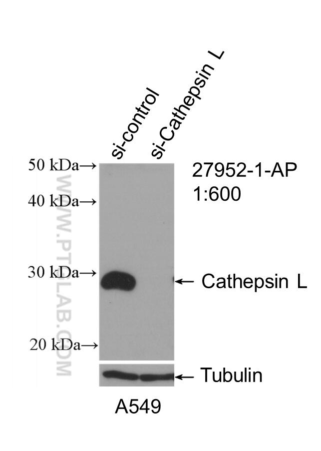 Western Blot (WB) analysis of A549 cells using Cathepsin L Polyclonal antibody (27952-1-AP)