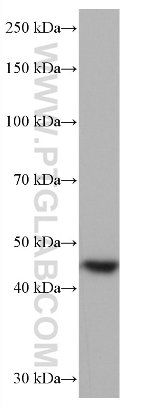Western Blot (WB) analysis of HUVEC cells using Cathepsin L Monoclonal antibody (66914-1-Ig)