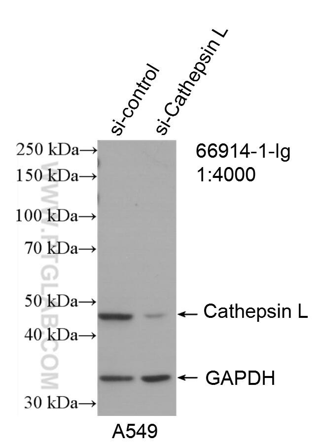 Western Blot (WB) analysis of A549 cells using Cathepsin L Monoclonal antibody (66914-1-Ig)