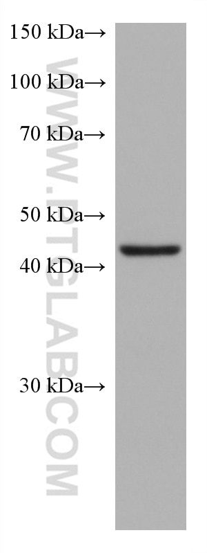 WB analysis of HeLa using 66914-1-Ig