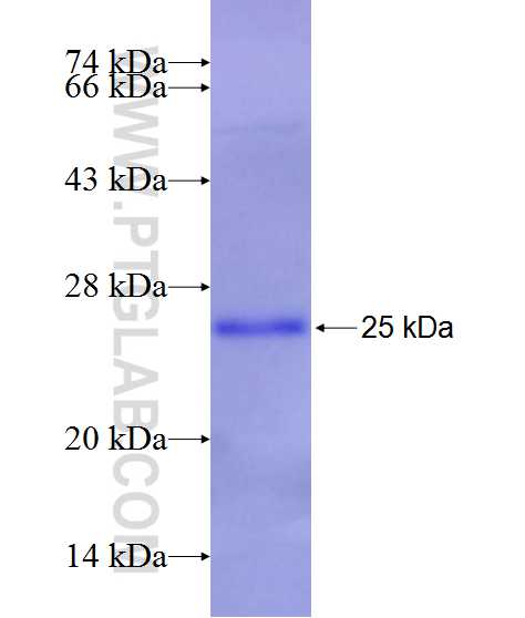 Cathepsin L fusion protein Ag27770 SDS-PAGE