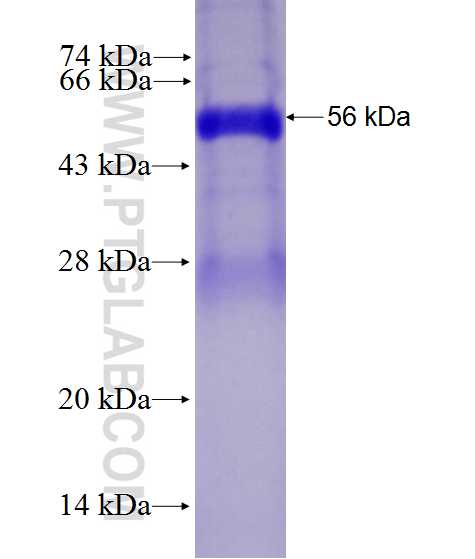 Cathepsin L fusion protein Ag27813 SDS-PAGE