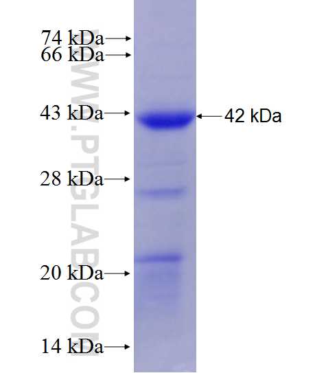 Cathepsin L fusion protein Ag27951 SDS-PAGE