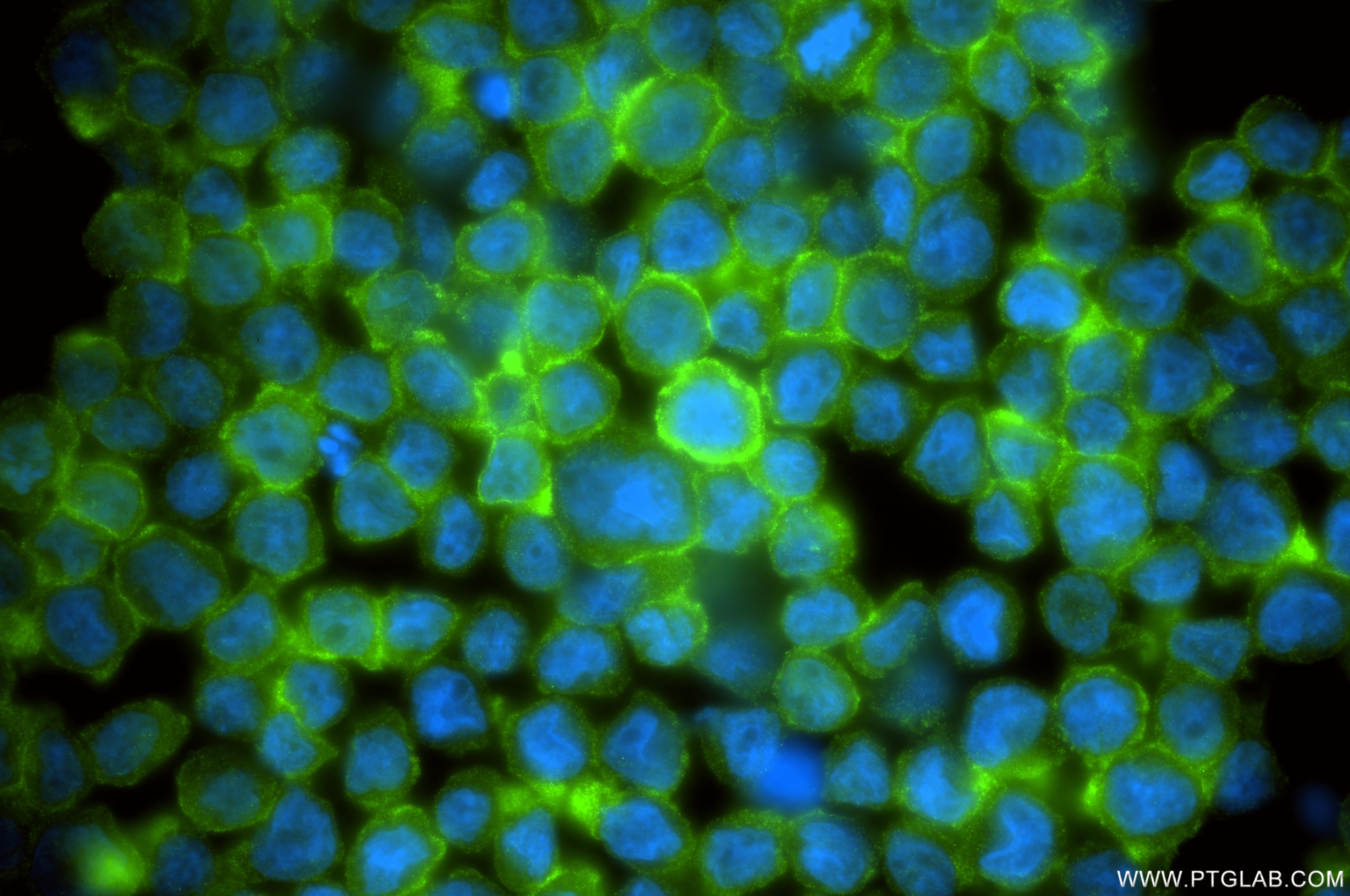 IF Staining of THP-1 using 86948-1-RR (same clone as 86948-1-PBS) Immunofluorescence (IF) / fluorescent staining of THP-1 cells using Cathepsin S Recombinant monoclonal antibody (86948-1-RR)