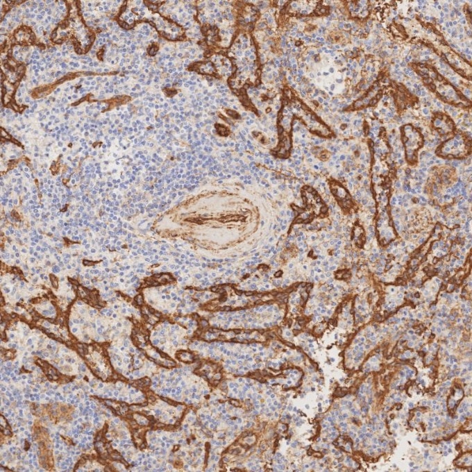 Immunohistochemistry (IHC) staining of human spleen tissue using Caveolin-1 Recombinant monoclonal antibody (84044-1-RR)