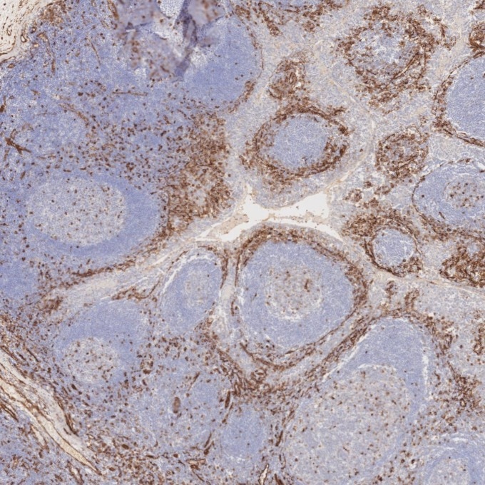 Immunohistochemistry (IHC) staining of human tonsillitis tissue using Caveolin-1 Recombinant monoclonal antibody (84044-1-RR)