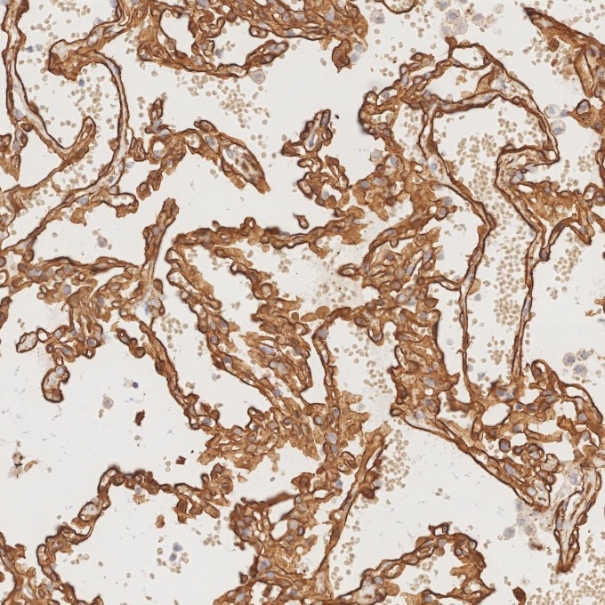 Immunohistochemistry (IHC) staining of human lung tissue using Caveolin-1 Recombinant monoclonal antibody (84044-1-RR)