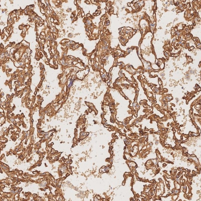 Immunohistochemistry (IHC) staining of human lung tissue using Caveolin-1 Recombinant monoclonal antibody (84044-1-RR)