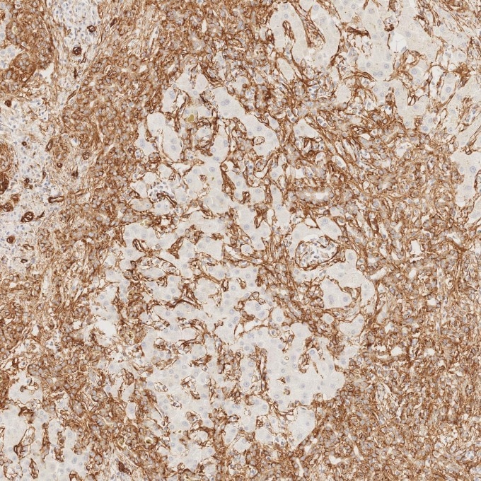 Immunohistochemistry (IHC) staining of human liver tissue using Caveolin-1 Recombinant monoclonal antibody (84044-1-RR)