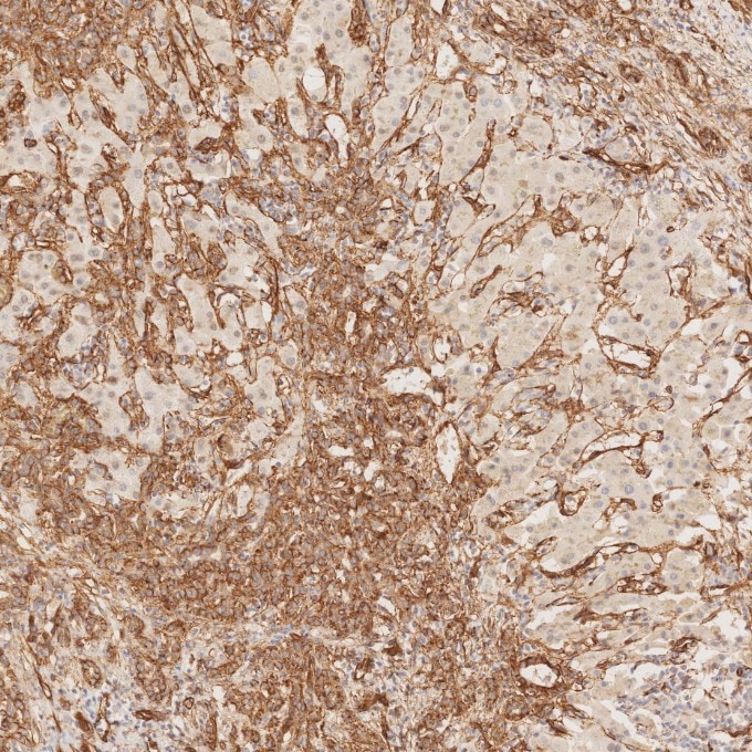 Immunohistochemistry (IHC) staining of human liver tissue using Caveolin-1 Recombinant monoclonal antibody (84044-1-RR)