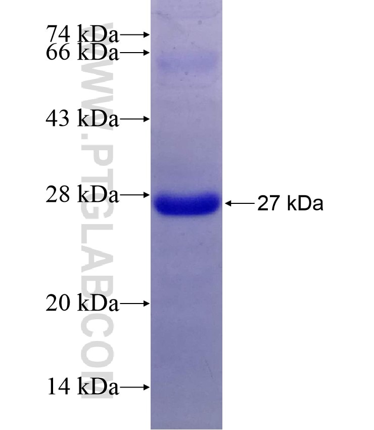 Caveolin-1 fusion protein Ag8049 SDS-PAGE