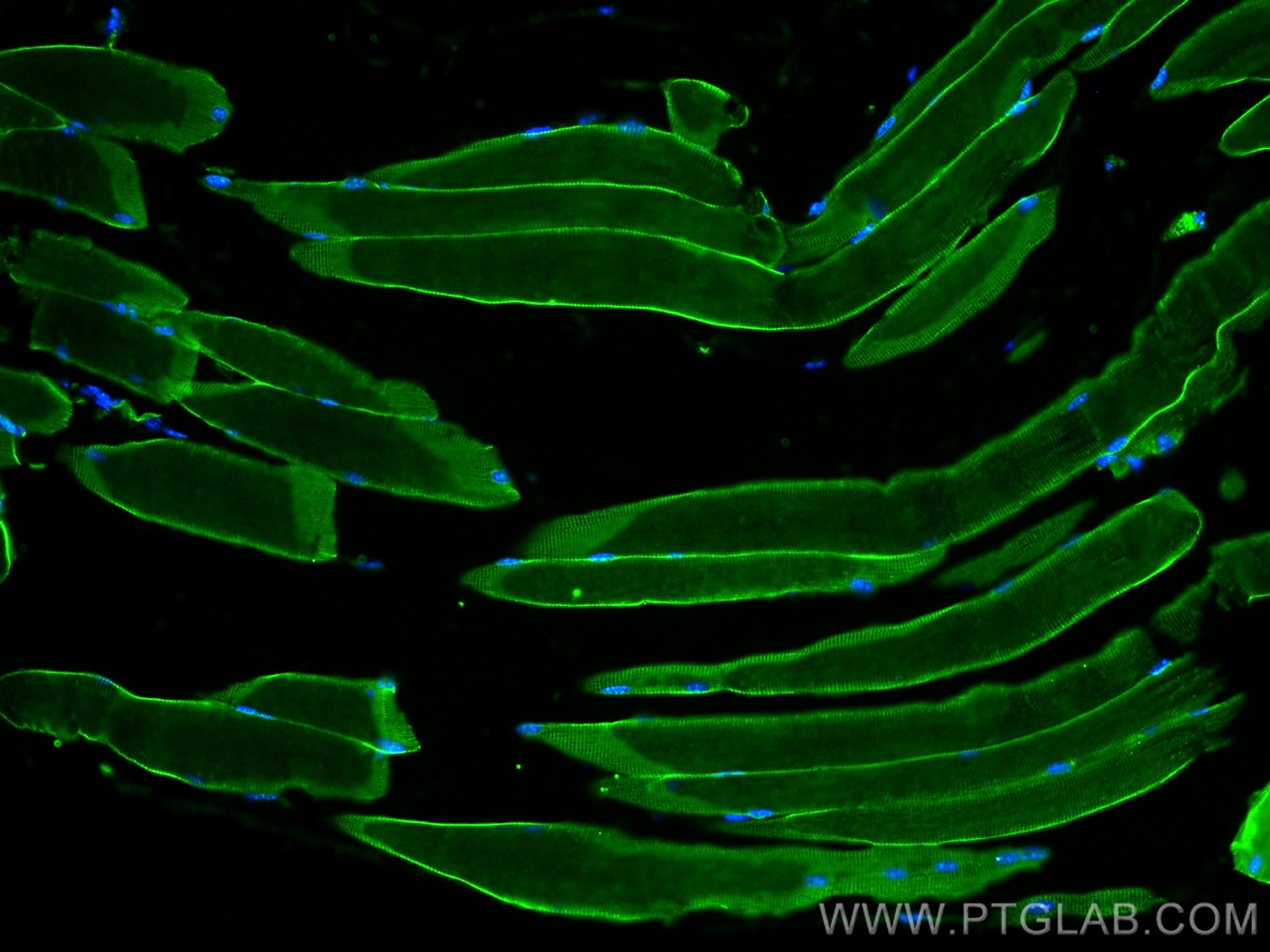 Immunofluorescence (IF) / fluorescent staining of mouse skeletal muscle tissue using Caveolin-3 Polyclonal antibody (28358-1-AP)