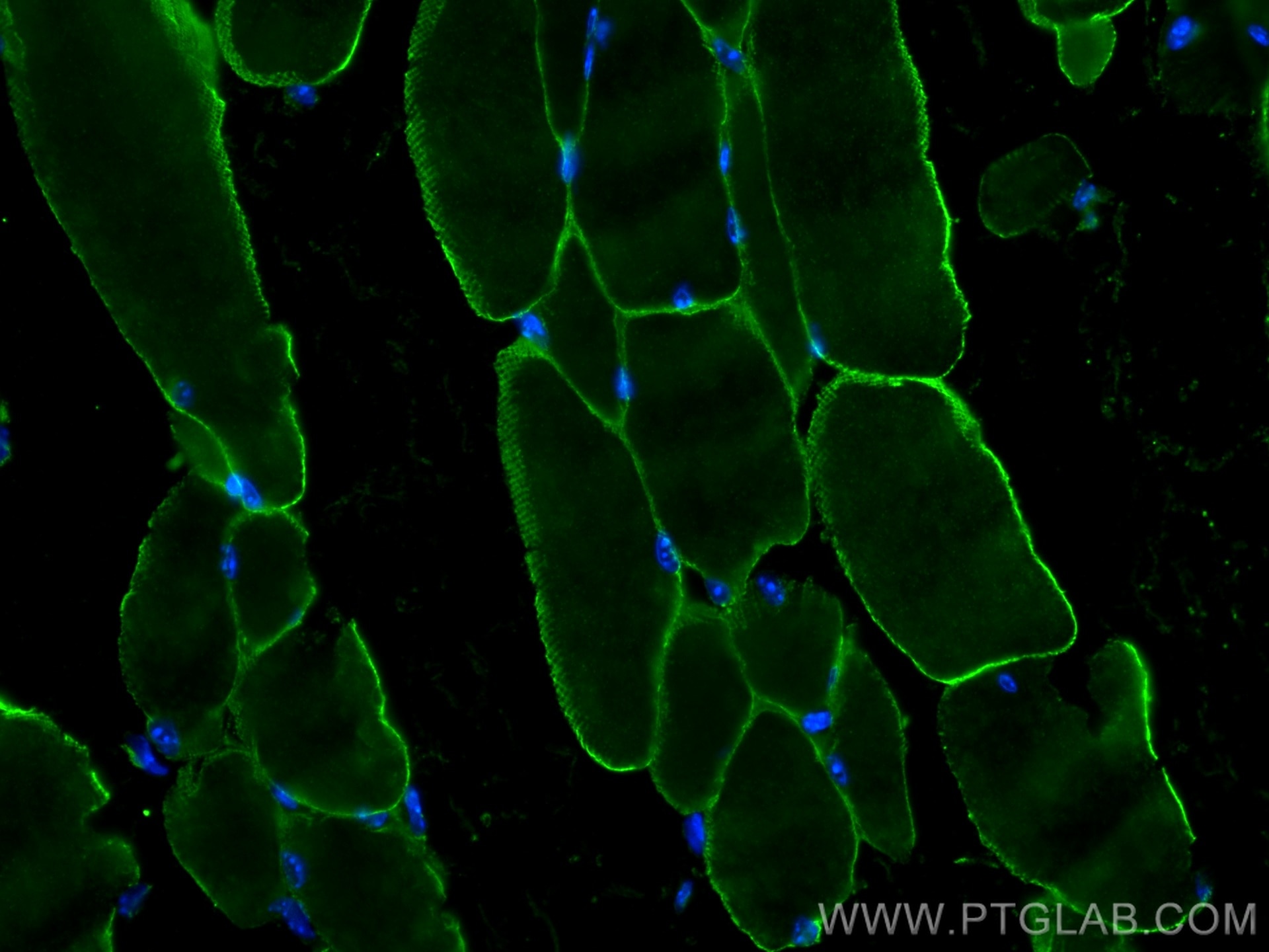 Immunofluorescence (IF) / fluorescent staining of mouse skeletal muscle tissue using Caveolin-3 Polyclonal antibody (28358-1-AP)