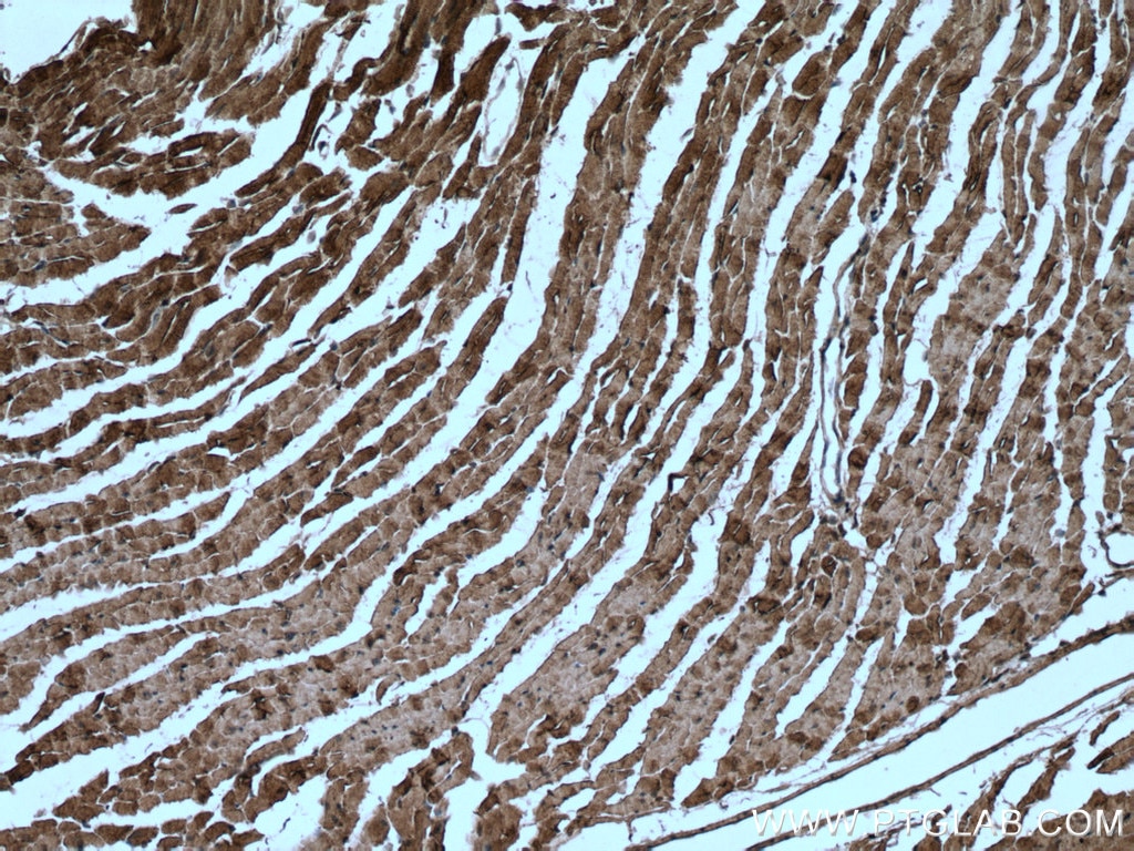 Immunohistochemistry (IHC) staining of mouse heart tissue using Caveolin-3 Polyclonal antibody (28358-1-AP)