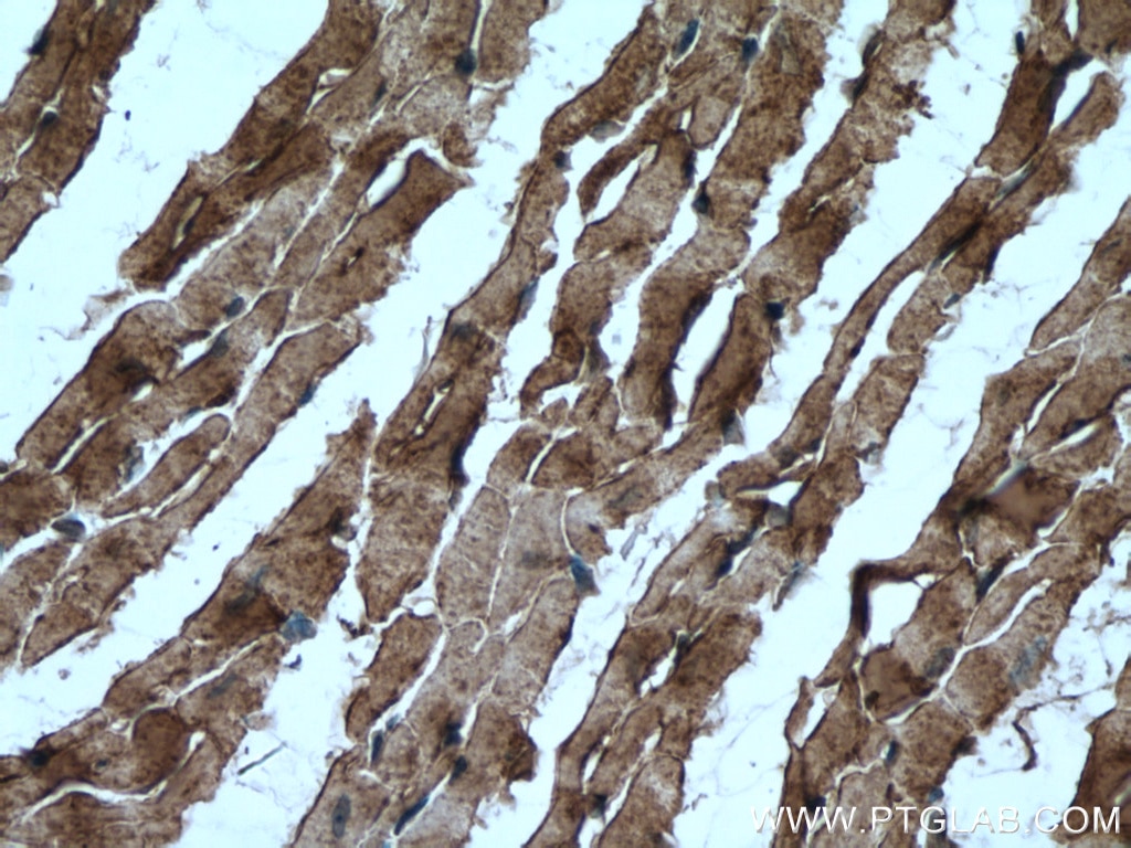 Immunohistochemistry (IHC) staining of mouse heart tissue using Caveolin-3 Polyclonal antibody (28358-1-AP)
