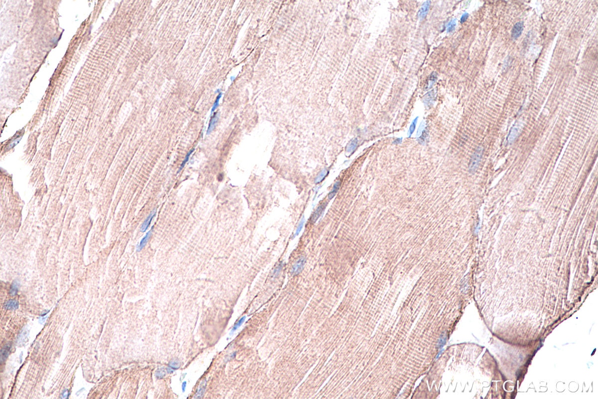 Immunohistochemistry (IHC) staining of rat skeletal muscle tissue using Caveolin-3 Polyclonal antibody (28358-1-AP)