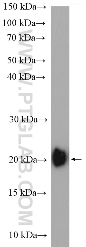 Western Blot (WB) analysis of mouse heart tissue using Caveolin-3 Polyclonal antibody (28358-1-AP)