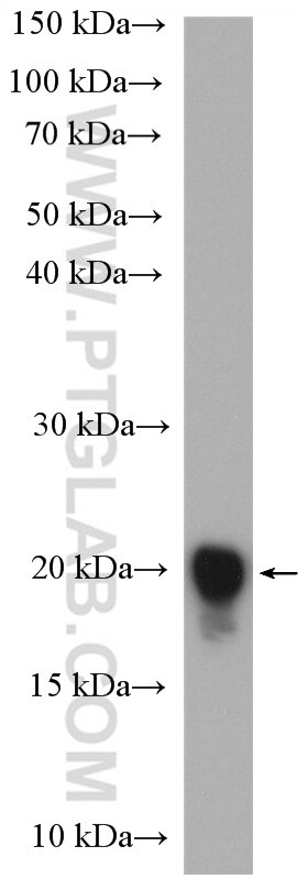 Western Blot (WB) analysis of mouse skeletal muscle tissue using Caveolin-3 Polyclonal antibody (28358-1-AP)