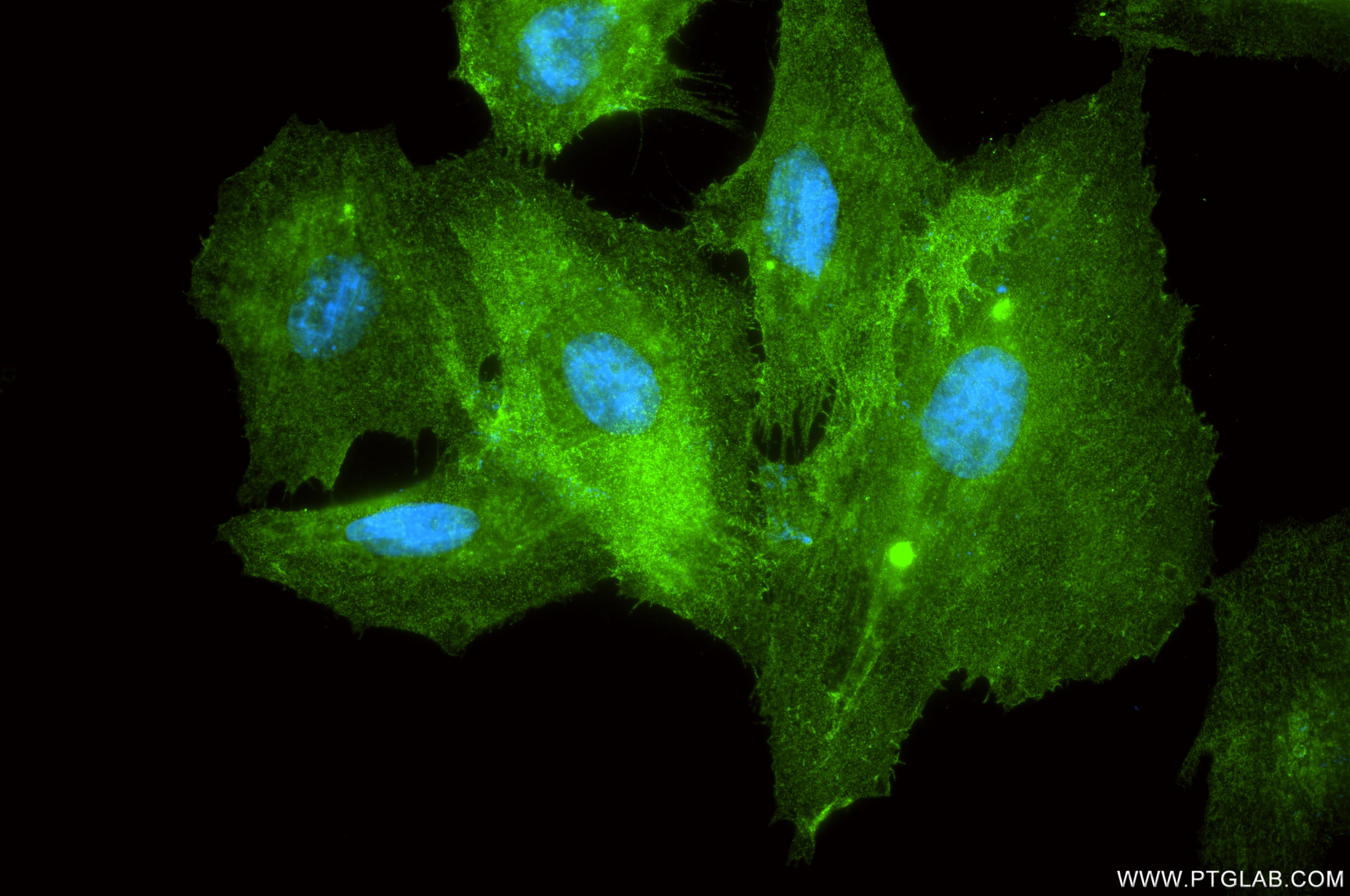 Immunofluorescence (IF) / fluorescent staining of H9C2 cells using Caveolin-3 Recombinant monoclonal antibody (85190-1-RR)