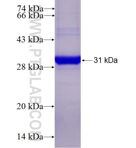 Caveolin-3 fusion protein Ag28009 SDS-PAGE