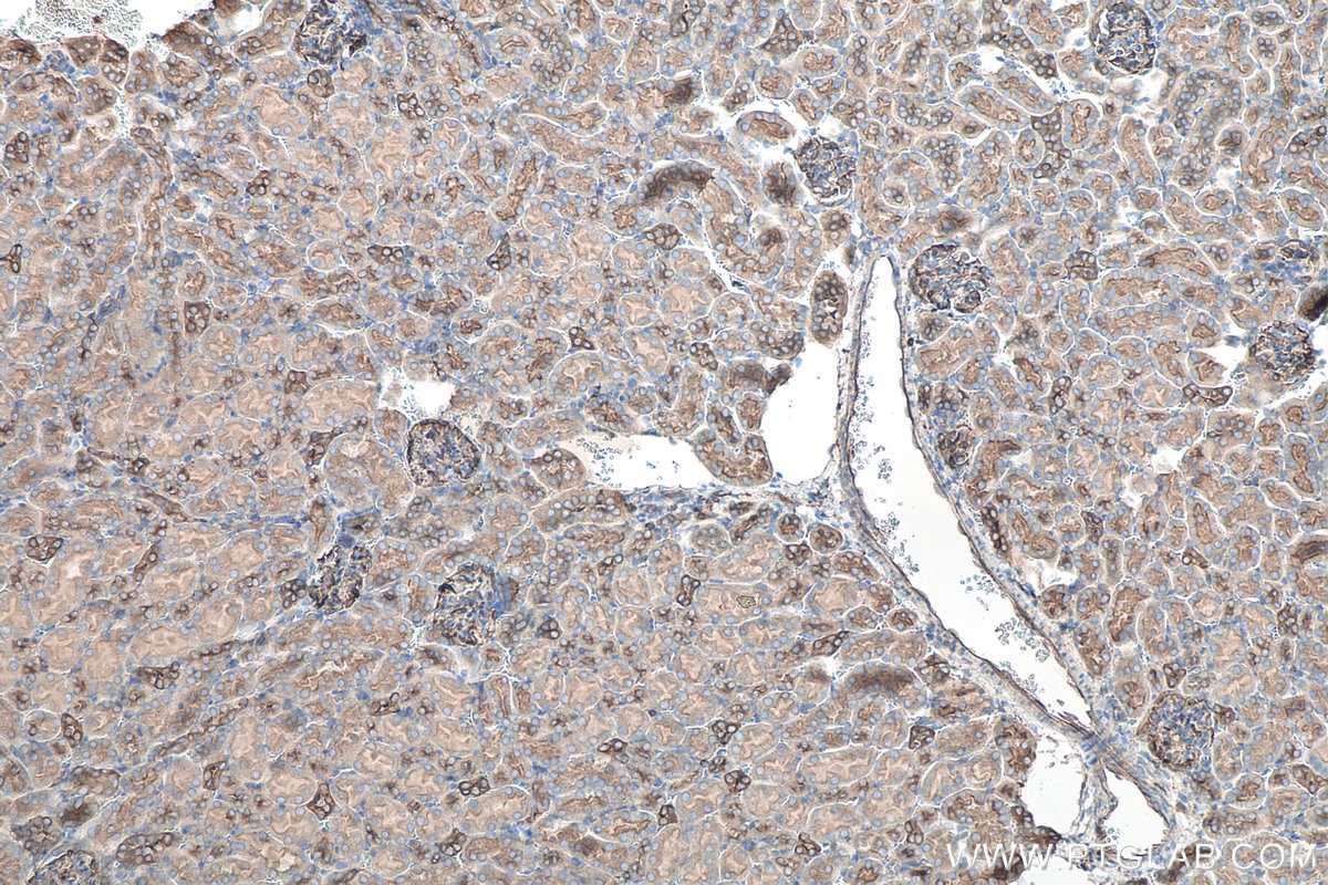 Immunohistochemistry (IHC) staining of mouse kidney tissue using Cd2ap Polyclonal antibody (24122-1-AP)