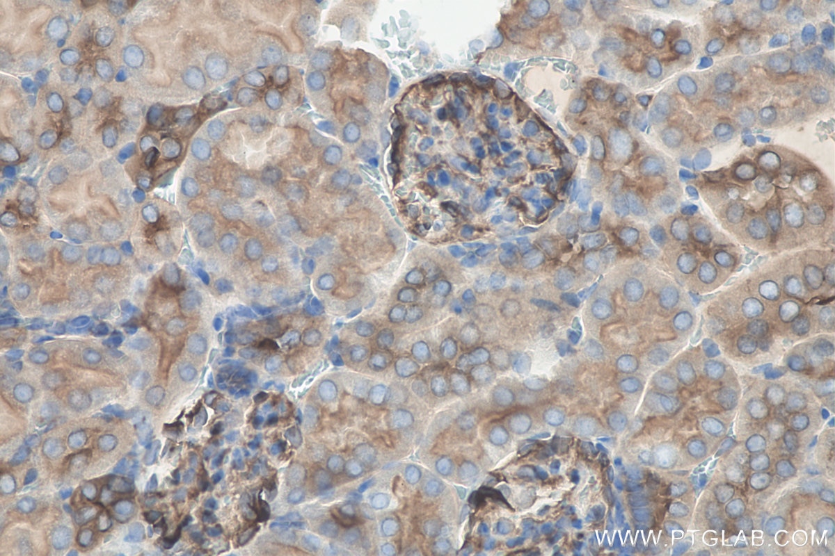 IHC staining of mouse kidney using 24122-1-AP
